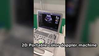US15 Plus 2D Portable color doppler machine