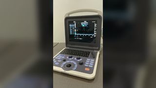 BR-US22 Ultrasound machine