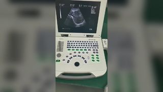Full-digital laptop Ultrasound Diagnostic System 80element BR-US11