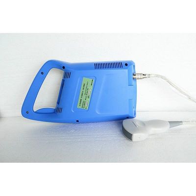 Full Digital Palmtop Ultrasound Scanner