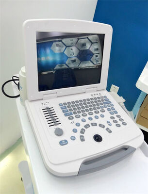 Full-Digital Laptop Ultrasound Diagnostic System 96 Element