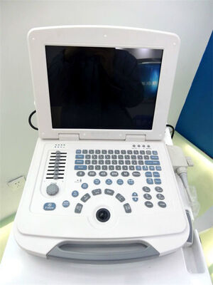 Full-Digital Laptop Ultrasound Diagnostic System 96 Element