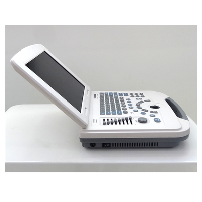Full-Digital Laptop Ultrasound Diagnostic System 96 Element