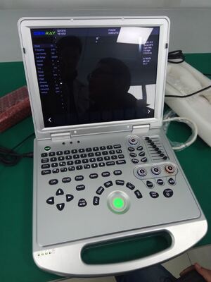 2D Portable color doppler machine