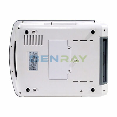 12"  Fetal Monitor